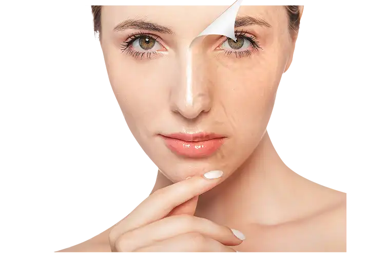 Toxina Botulínica na Harmonização Facial